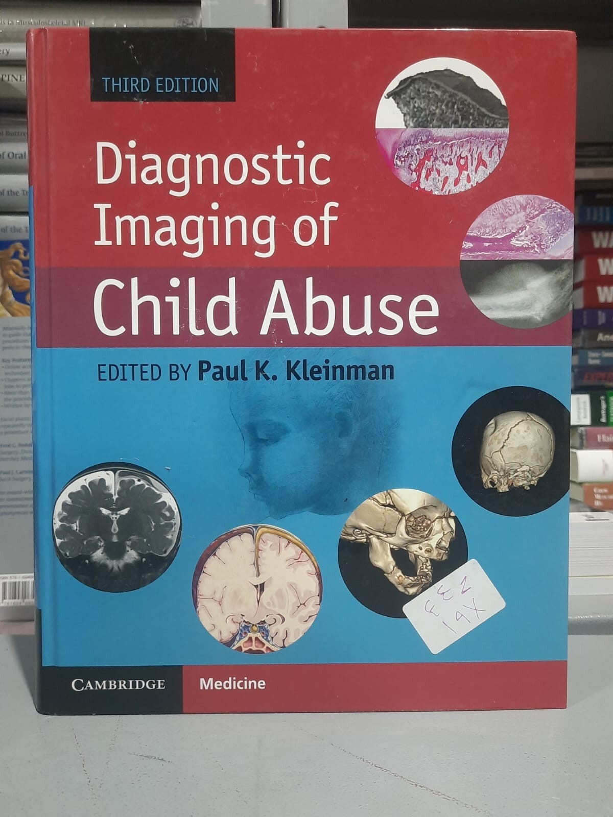 Diagnostic Imaging of Child Abuse