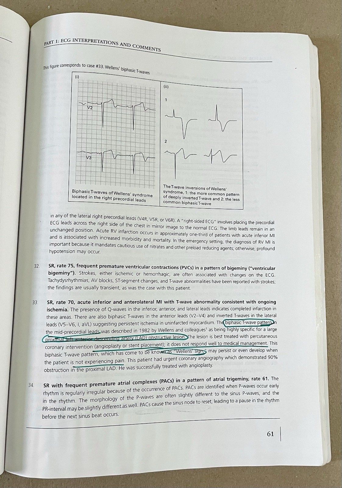 ECGs for the Emergency Physician 1, Amal Mattu & William Brady (2003, PB)