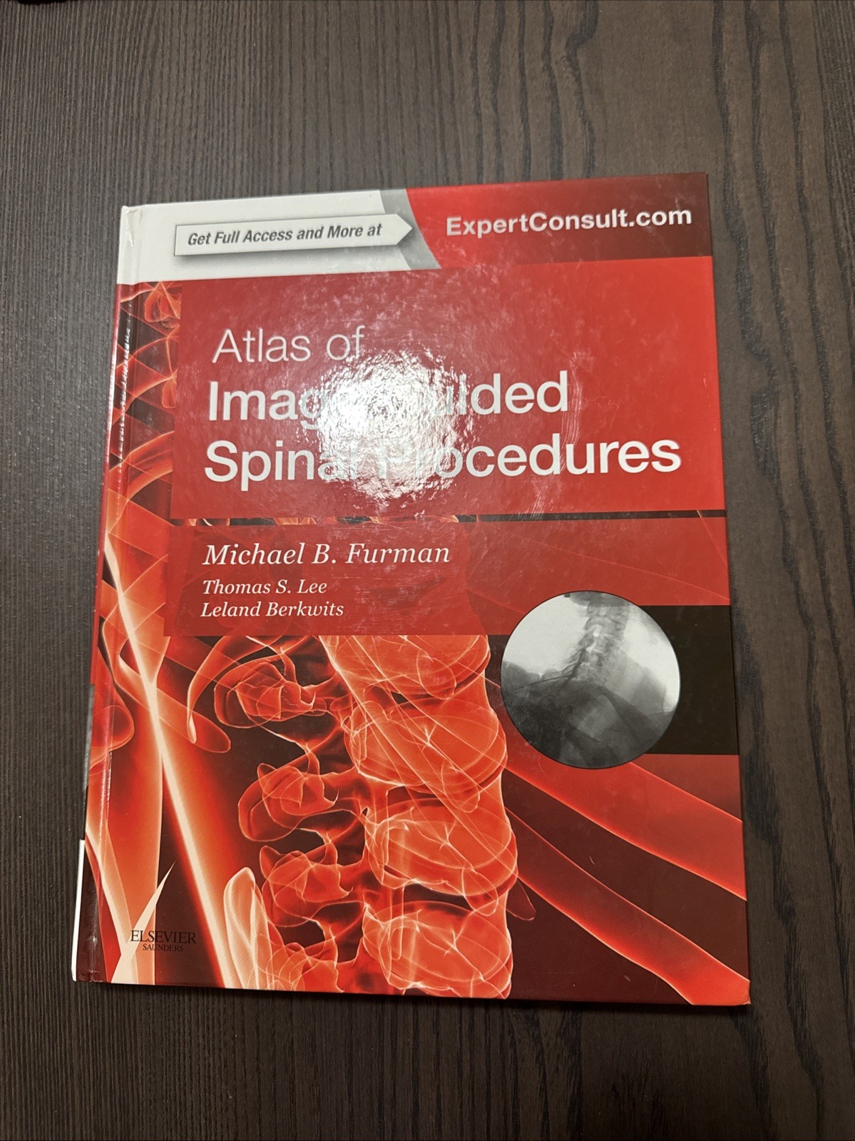 Atlas of Image-Guided Spinal Procedures: Expert Consult – Online and Print