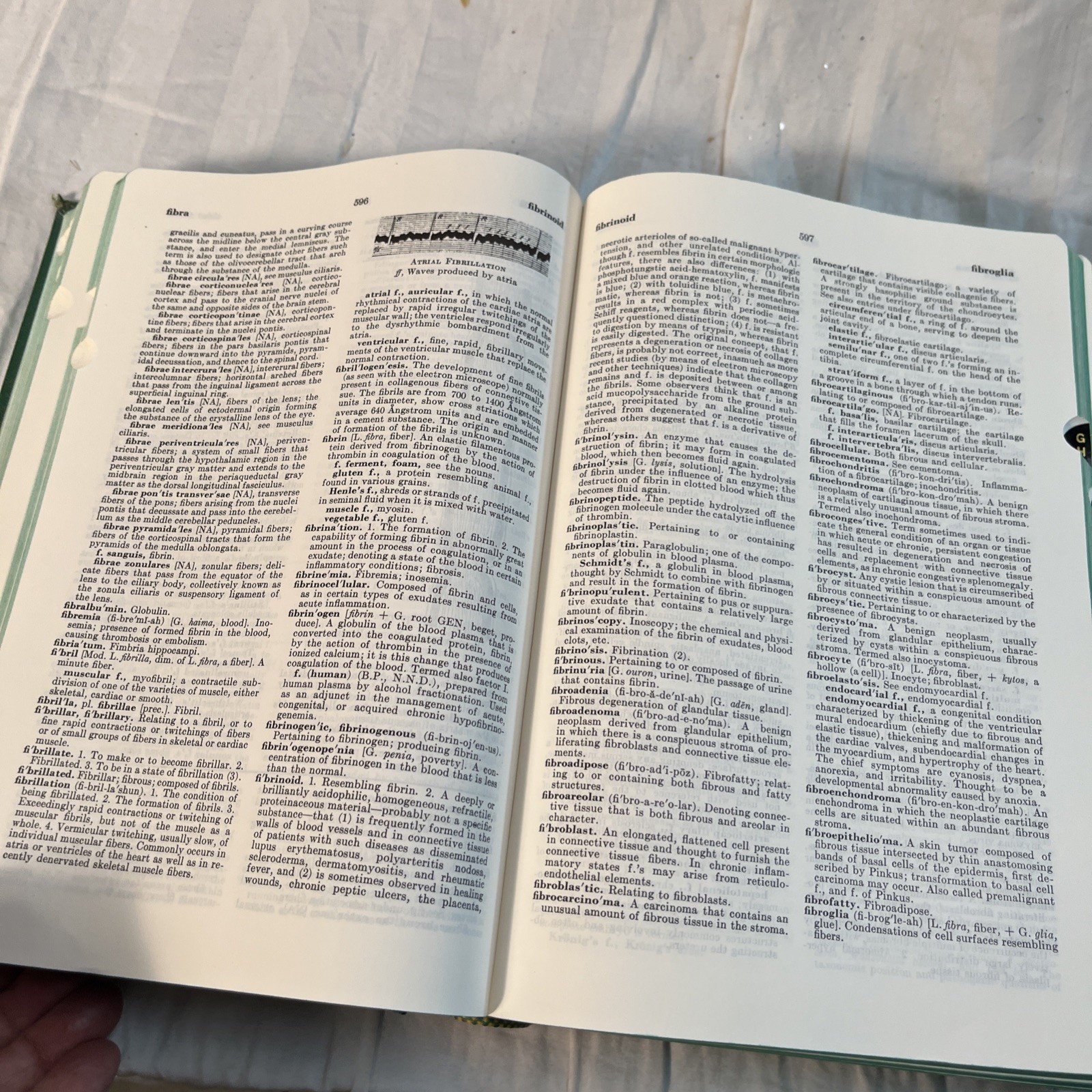 VINTAGE 1970 LARGE Stedman’s Medical Dictionary – 21st Illustrated Edition