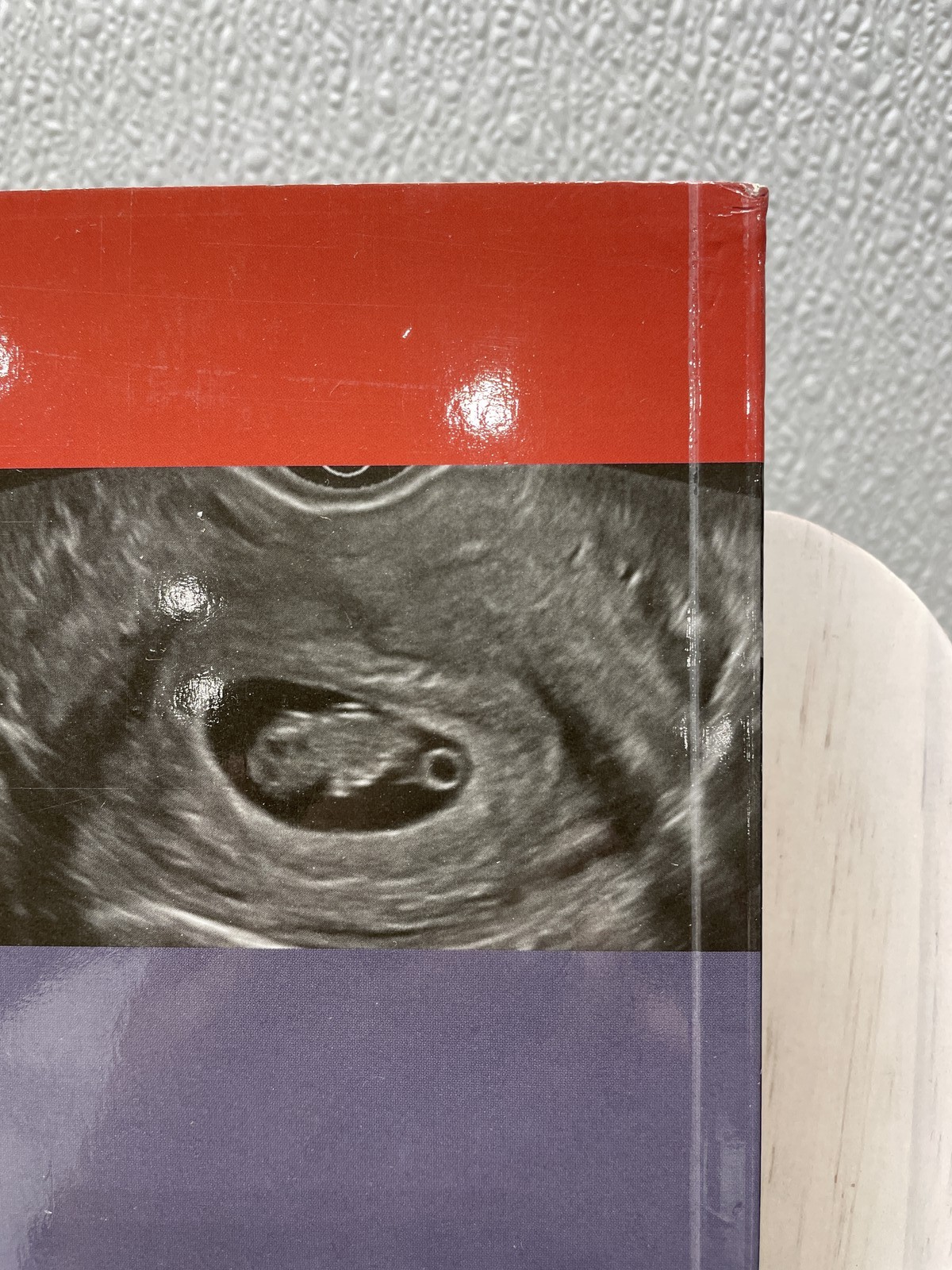 Sonography Scanning: Principles and Protocols by M. Robert deJong 5E Paperback