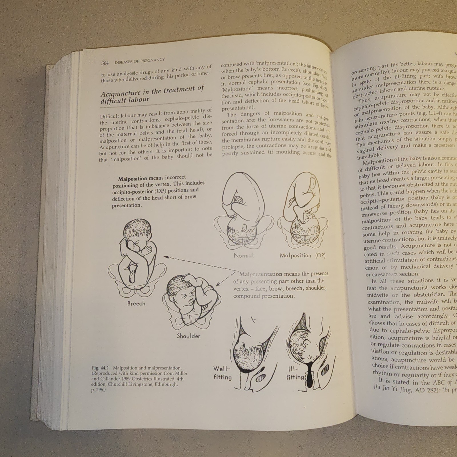 Obstetrics and Gynecology in Chinese Medicine by Giovanni Maciocia