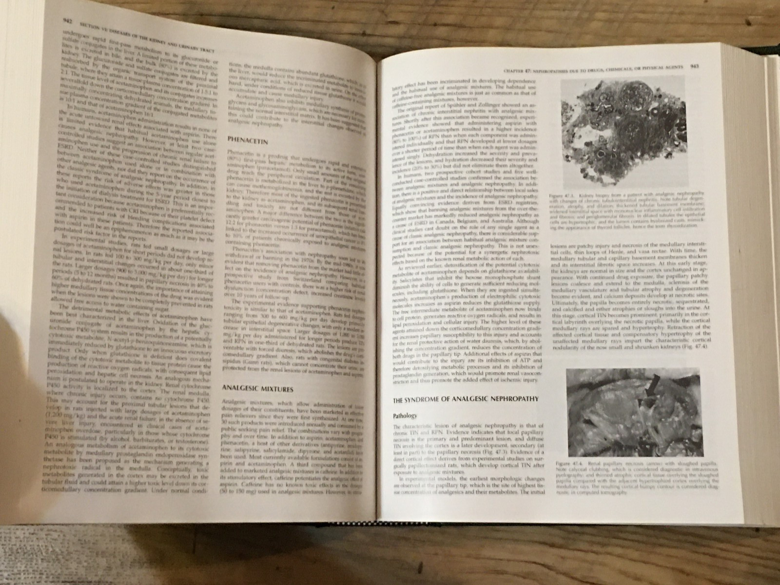Massry And Glassock’s TEXTBOOK OF NEPHROLOGY Fourth Edition
