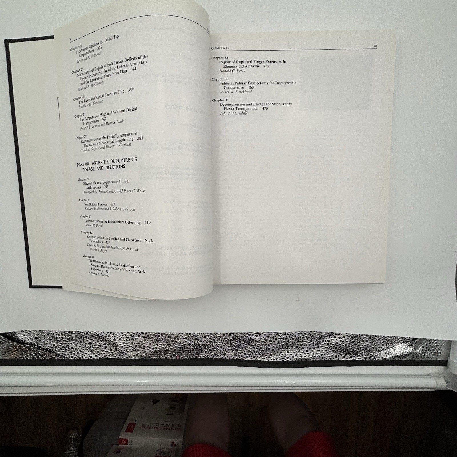 Master Techniques In Orthopaedic Surgery: The Hand by James W. Stickland