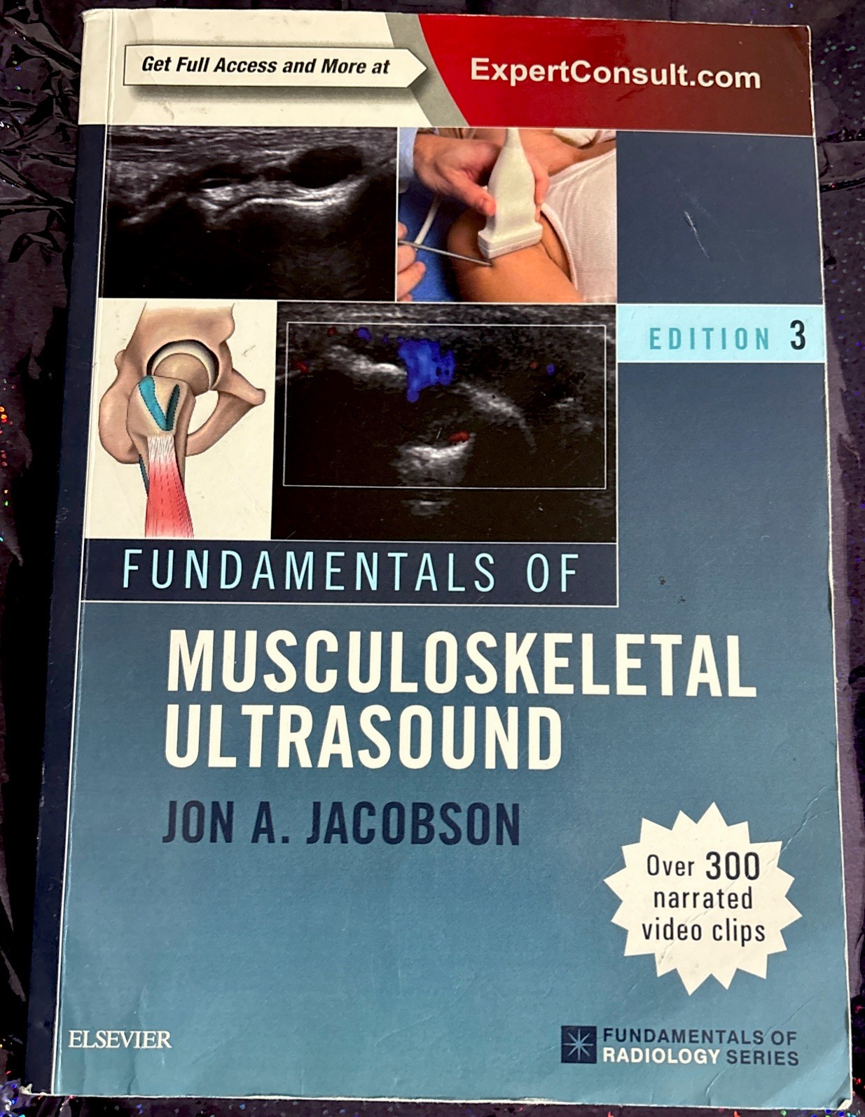 Fundamentals of Musculoskeletal Ultrasound – 3E (Fundamentals of Radiology) PB