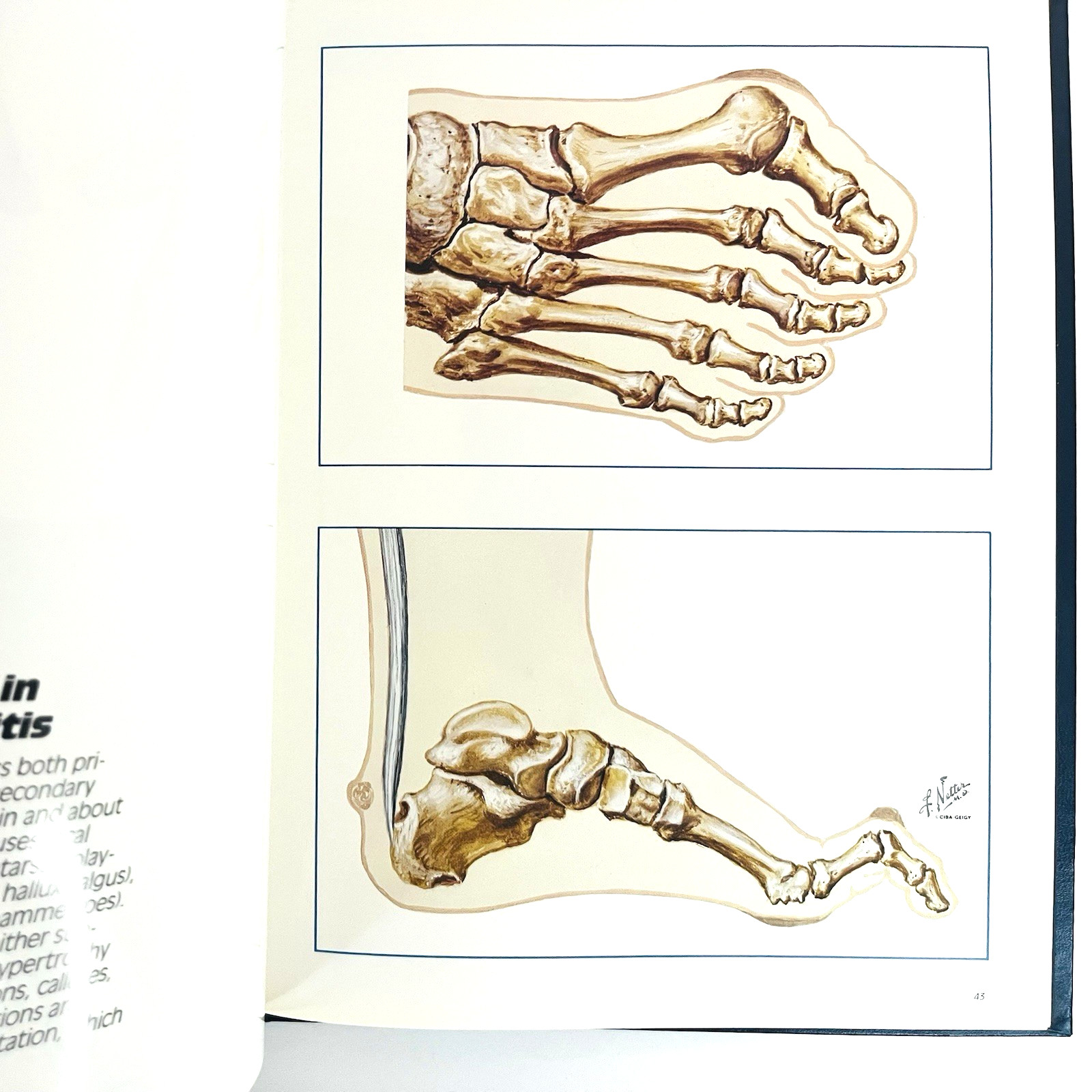 Voltaren Diclofenac Sodium Special Edition Book Hardcover Limited Edition 1987