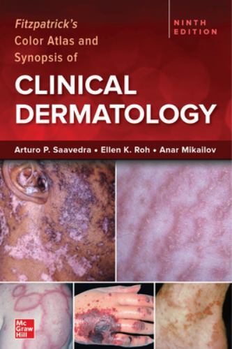 Fitzpatrick’s Color Atlas and Synopsis of Clinical Dermatology, Ninth Edition by